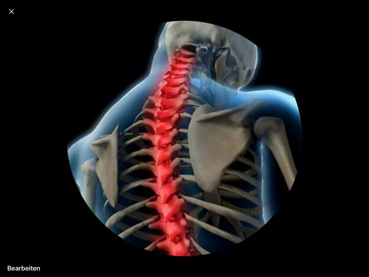 Bild 6: rücken fit Intensiv Gel bei Rückenschmerzen