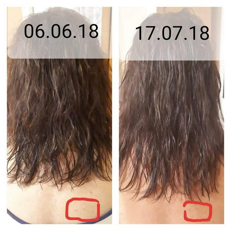 Bild 14: Haar-Wachstum-Aktivierungs Serie Bio Rehab tianDE- ohne Sulfate und Parabene