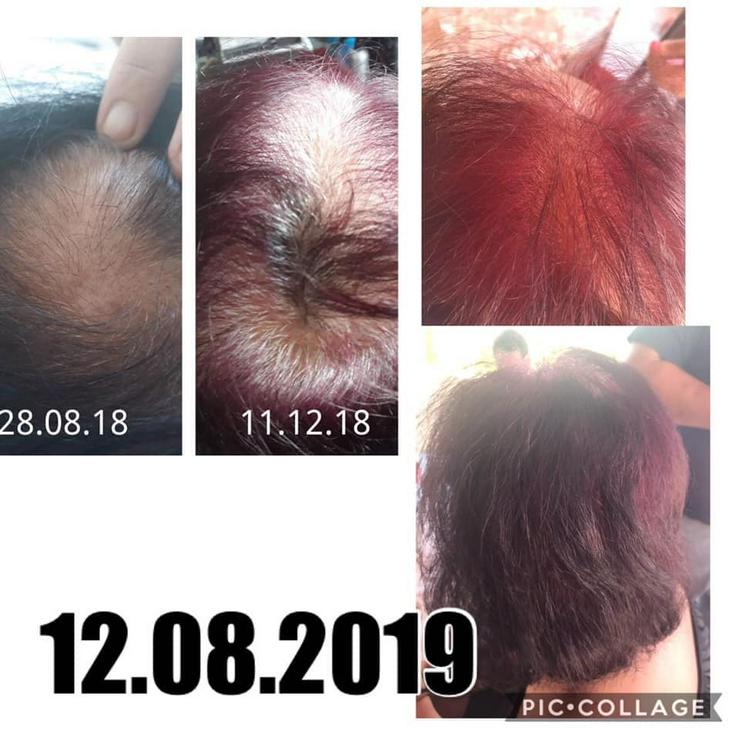 Bild 12: Haar-Wachstum-Aktivierungs Serie Bio Rehab tianDE- ohne Sulfate und Parabene