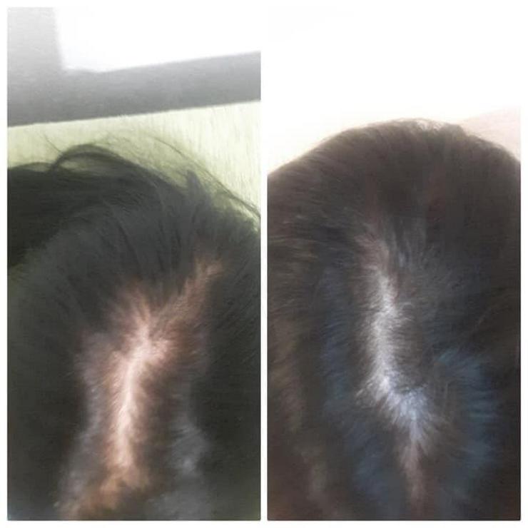 Bild 11: Haar-Wachstum-Aktivierungs Serie Bio Rehab tianDE- ohne Sulfate und Parabene
