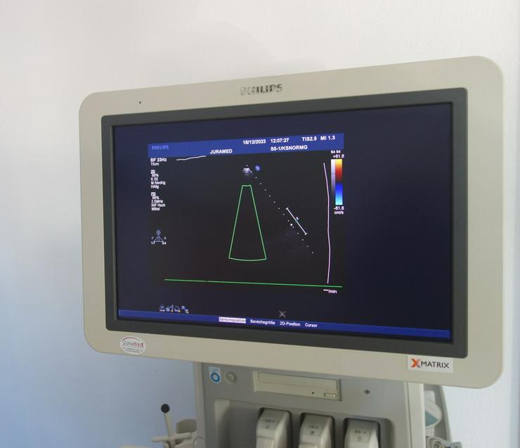 Bild 2: Farbdoppler Philips iE33 Ultraschallgerät mit 3 Sonden und Stiftsonde