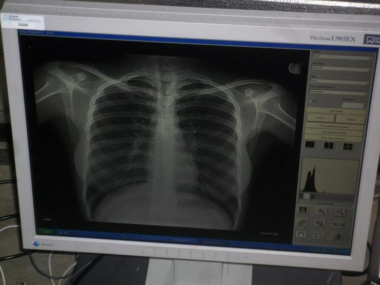 Bild 2: Kodak Orex PcCR 1417 ACL4 Digital X-ray Röntgen Imaging 